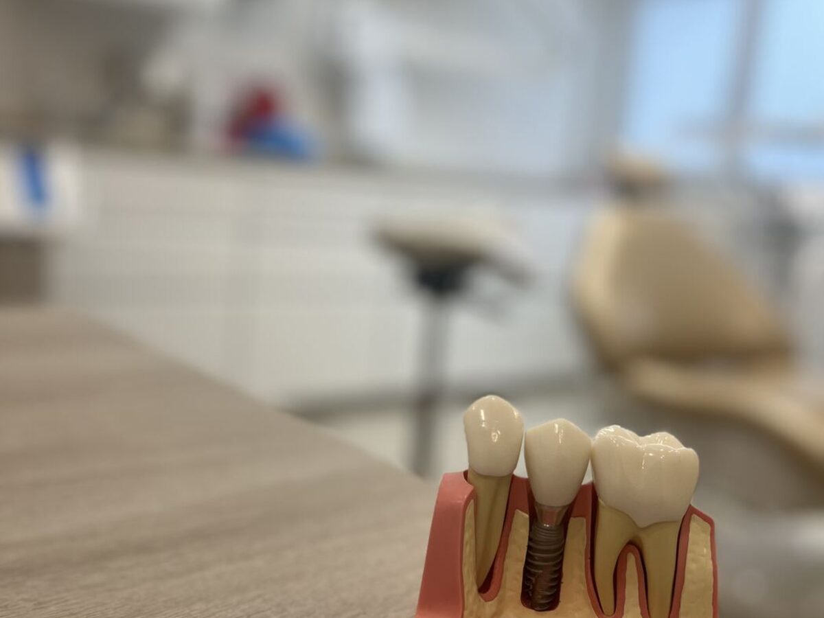 Modèle pédagogique d’un implant dentaire en coupe